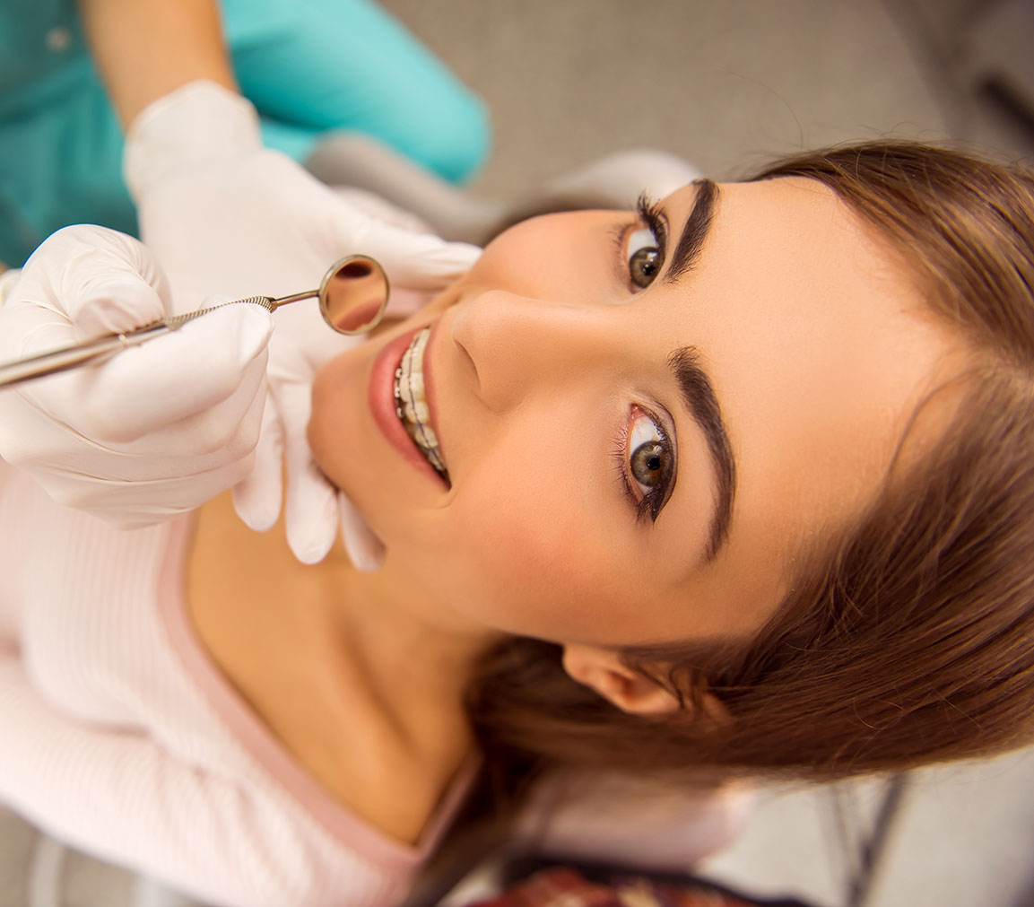 Braces in West Covina CA