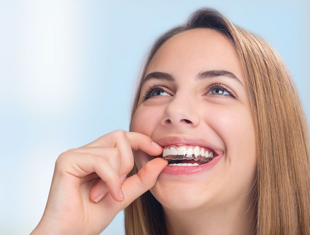 Affordable Invisalign Clear Braces Carrollwood • Wesley Chapel